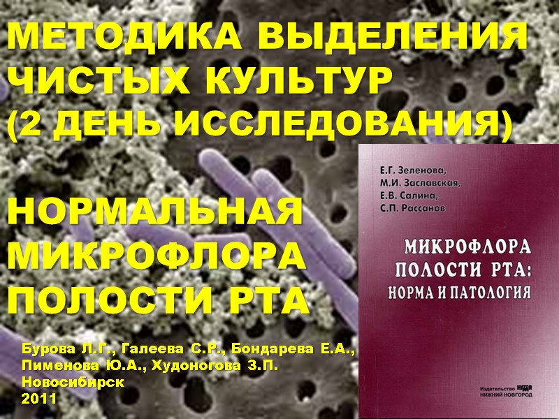 МЕТОДИКА ВЫДЕЛЕНИЯ ЧИСТЫХ КУЛЬТУР (2 ДЕНЬ ИССЛЕДОВАНИЯ)  НОРМАЛЬНАЯ МИКРОФЛОРА  ПОЛОСТИ РТА 